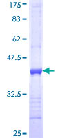 12.5% SDS-PAGE Stained with Coomassie Blue